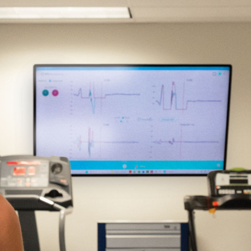 A monitor displays real-time electromyography data