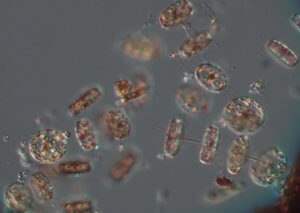 Photo of microscopic Thalassiosira phytoplankton from Sandy Hook Bay